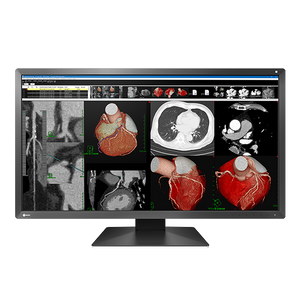 Eizo MX317W 8MP 30" Radiology Monitor