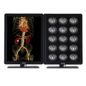Barco MDNC-3521 3MP 21" Radiology Monitor