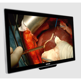 Barco MDSC‑8527 SSTF/NXF 27" Surgical Monitor
