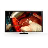 Barco MDSC-8532 32" Surgical Monitor