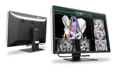 Eizo RX670 6MP 30" Radiology Monitor