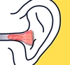 IN-EAR earplugs