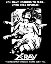 X-Ray T-Shirt
