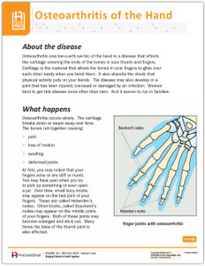 Osteoarthritis of the Hand Tearpad (50 sheets per pad) (550A) - front side