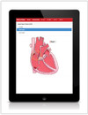 PCA: Pediatric Cardiology Animations Application (Personal Use) (313P) - tablet view showing a heart animation