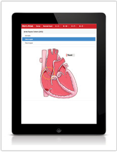 PCA: Pediatric Cardiology Animations Application (Personal Use) (313P) - tablet view showing a heart animation