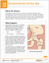 Osteoarthritis of the Hip Tearpad (50 sheets per pad) (551A) - front side