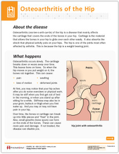 Osteoarthritis of the Hip Tearpad (50 sheets per pad) (551A) - front side