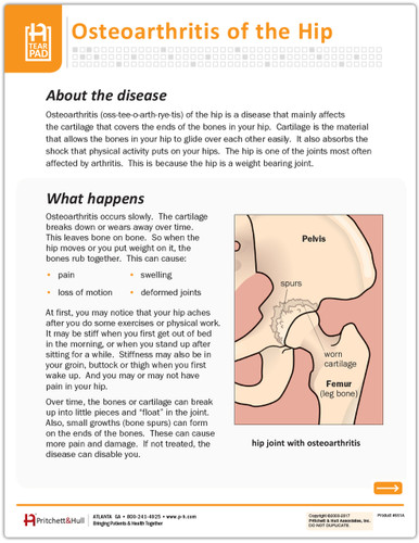 Osteoarthritis of the Hip Tearpad (50 sheets per pad) (551A) - front side