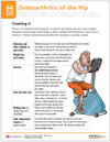 Osteoarthritis of the Hip Tearpad (50 sheets per pad) (551A) - back side