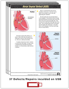 Heart Defect Teaching Sheets (307J) - sample teaching sheet