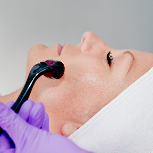 Dermal Rolling