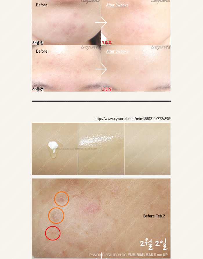 koreacosmetic-koreaskincare-serum-ciracle-c15-redspotwhiteserum1.jpg