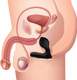 P-Swell 12 Mode Inflatable Prostate Vibrator by Prostatic Play - view 5