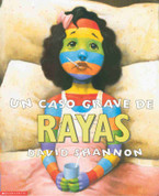 Un caso grave de rayas - A Bad Case of Stripes