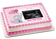 Ultrasound Pink Edible Baby Shower Cake Toppers, With Custom Sonogram Pictures - Edible Cake Topper OR Cupcake Topper, Decor