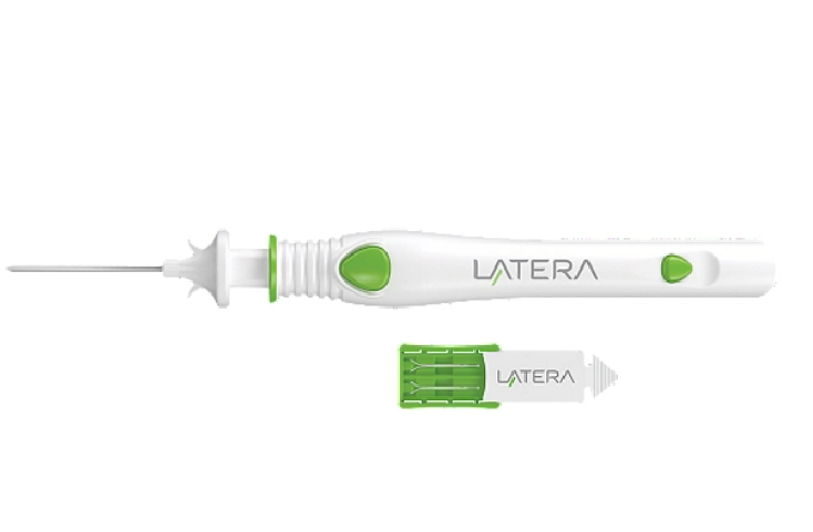 Stryker LATSYS20 Latera® Absorbable Nasal Implant System
