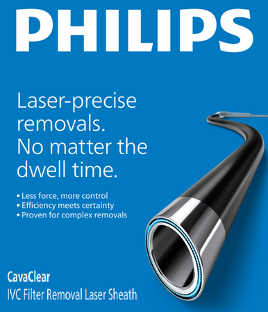 Philips 500-516 CavaClear IVC Filter Removal Laser Sheath, 16Fr, X 50cm, Minimum tip inner diameter 12.5 F / 0.164" / 4.17 mm. Box of 01