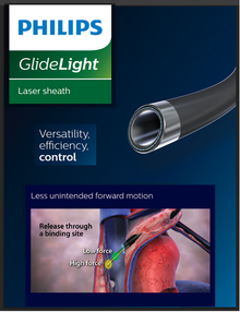 Philips 500-302 GlideLight laser Sheath, 14Fr, X 50cm, Maximum tip outer diameter 14.7 F / 0.192" / 4.88 mm. Box of 01