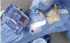 SPP99SA2AA - Cardinal Health™ Shoulder Arthroscopy Pack - Box of 3 SPP99SA2AA - Cardinal Health™ Shoulder Arthroscopy Pack - Box of 3