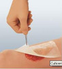66045562, Impregnated Dressing Cuticerin 3 X 3 Inch Gauze Cuticerin, Case of 120