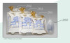 2163 J-VAC Sterile Closed Wound Drainage Reservoir, 300ml  Box of 10