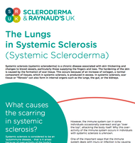 The Lungs in Systemic Sclerosis