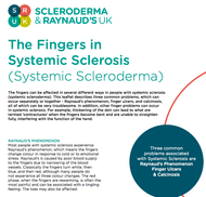 The Fingers in Systemic Sclerosis