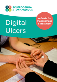 Digital Ulcers