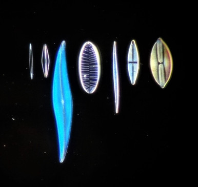 Darkfield at 10X Magnification